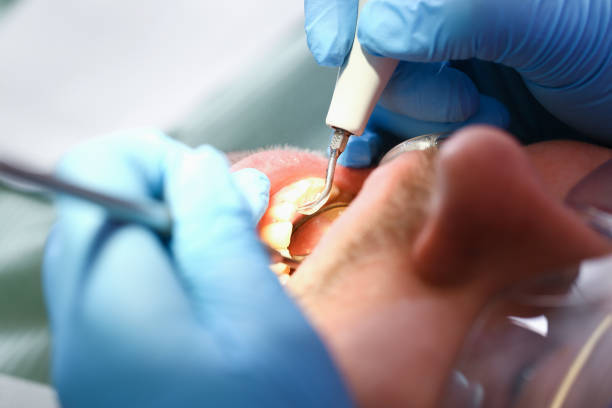 Best Dentist for Dental Trauma  in Newstle, CA